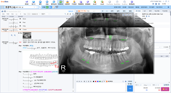 OneClick 파노라마 AI 진단 기능